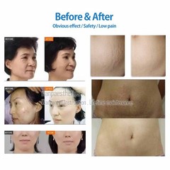 2026 New Professional Fractional M8 R-F Machine Skin Face Lift Skin Tightening