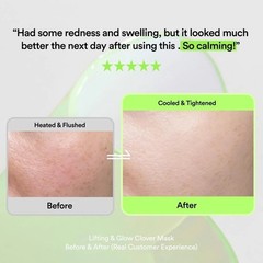 Skit Cica Azulene Gel Face Patches 4 Sets Soothing Redness K-Beauty