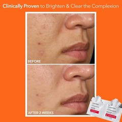 Extra Strength Daily Peel Pads – 2-Step Exfoliating Treatment for Anti-Aging, Sm