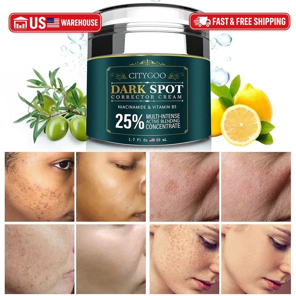 CITYGOO Dark Spot Remover for Face: Dark Spot Corrector Cream – Enriching Skin C