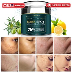 CITYGOO Dark Spot Remover for Face: Dark Spot Corrector Cream – Enriching Skin C
