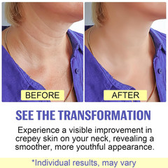 Neck Firming Cream – anti Aging Neck Tightening Cream for Sagging Skin, 1.7 Fl O