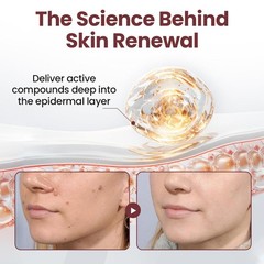 Daily Use Hydrating Renewal Cream with Black Rice – Gel for Smoother Skin