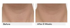 Strivectin TL advanced Neck Tightening Cream Plus with NIA114, 1oz, NEW W/O box