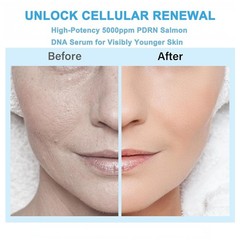PDRN Salmon DNA Serum, Anti-Aging & Hydration, Collagen, Glutathione, 30 Vials