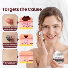 Daily Use Hydrating Renewal Cream with Black Rice – Gel for Smoother Skin